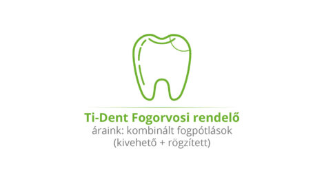 Kombinált fogpótlások (kivehető + rögzített)