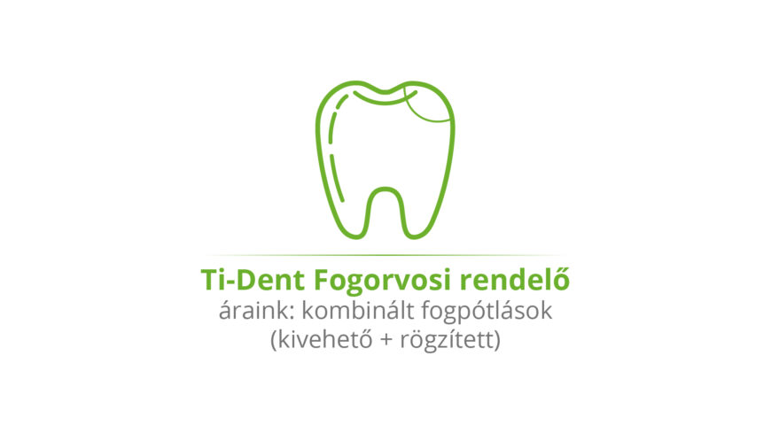 Ti-Dent Fogorvosi rendelő - Áraink: kombinált fogpótlások (kivehető + rögzített)
