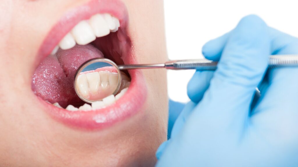 Ti-Dent Fogorvosi rendelő - fogászati kezelés